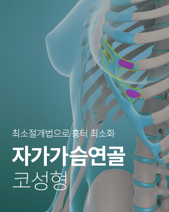 자가가슴연골